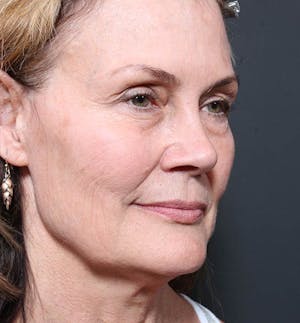 1609198779 5d5c432b 99e8 40ef a20e e638d49f099f