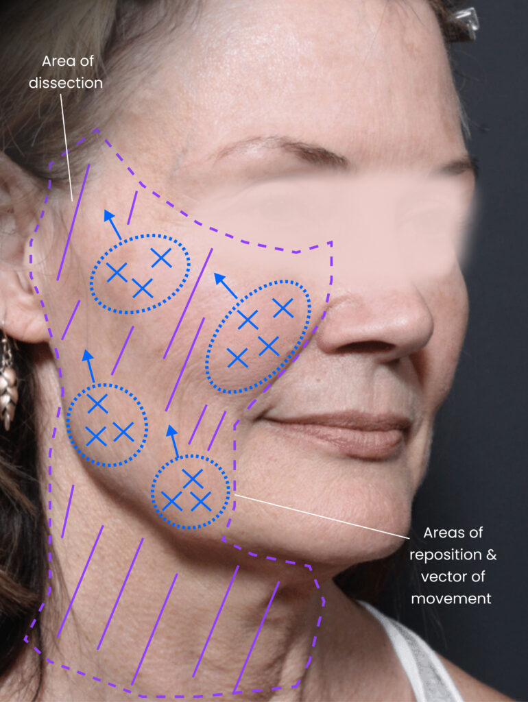 1733865996 1 before 1