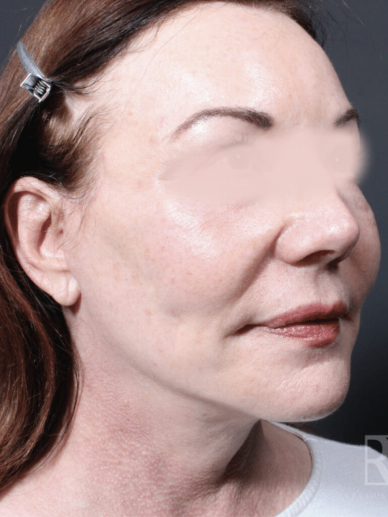 1733865997 3 after 1 1