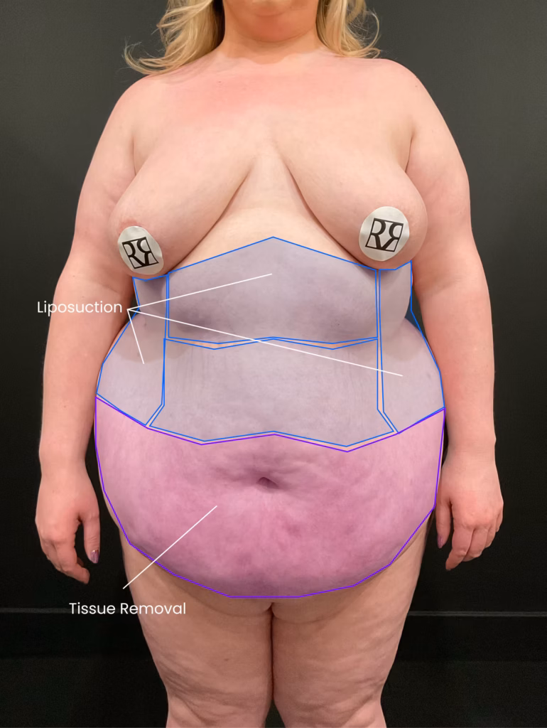 1734639247 3 before 1