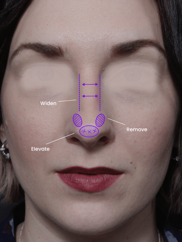 1741906052-female-3-before-2x 1741906052 female 3 before 2x